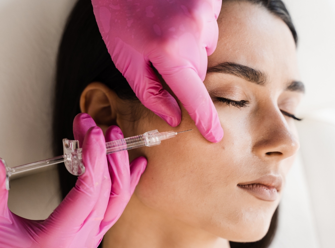 Mitos e verdades sobre ácido hialurônico: o que é seguro, o que envelhece e o que ninguém te explica
