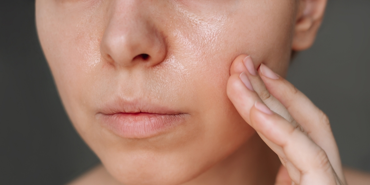 ROSTO OLEOSO: COMO DIMINUIR O BRILHO DA PELE? SAIBA TODOS OS DETALHES!